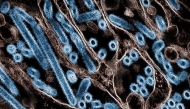 This undated handout image obtained on November 22, 2024, courtesy of the Centers for Disease Control and Prevention (CDC) and the National Institute of Allergy and Infectious Diseases shows a colorized transmission electron micrograph of avian influenza A H5N1 virus particles (blue), grown in Madin-Darby Canine Kidney (MDCK) epithelial cells. (Photo by Handout / National Institute of Allergy and Infectious Diseases / AFP) 