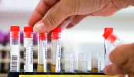 This photograph shows samples for screening test during the chikungunya epidemic at the biology centre of the University Hospital Center in Saint-Denis, France's overseas Indian ocean island of La Reunion, on April 10, 2025. Photo by Richard BOUHET / AFP
