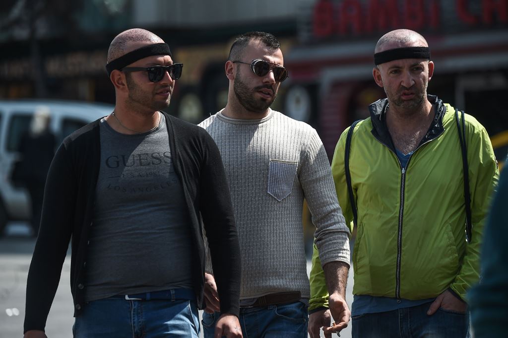 Patients walk on Taksim square after an hair transplant surgery on May 2, 2017 in Istanbul. AFP / OZAN KOSE
