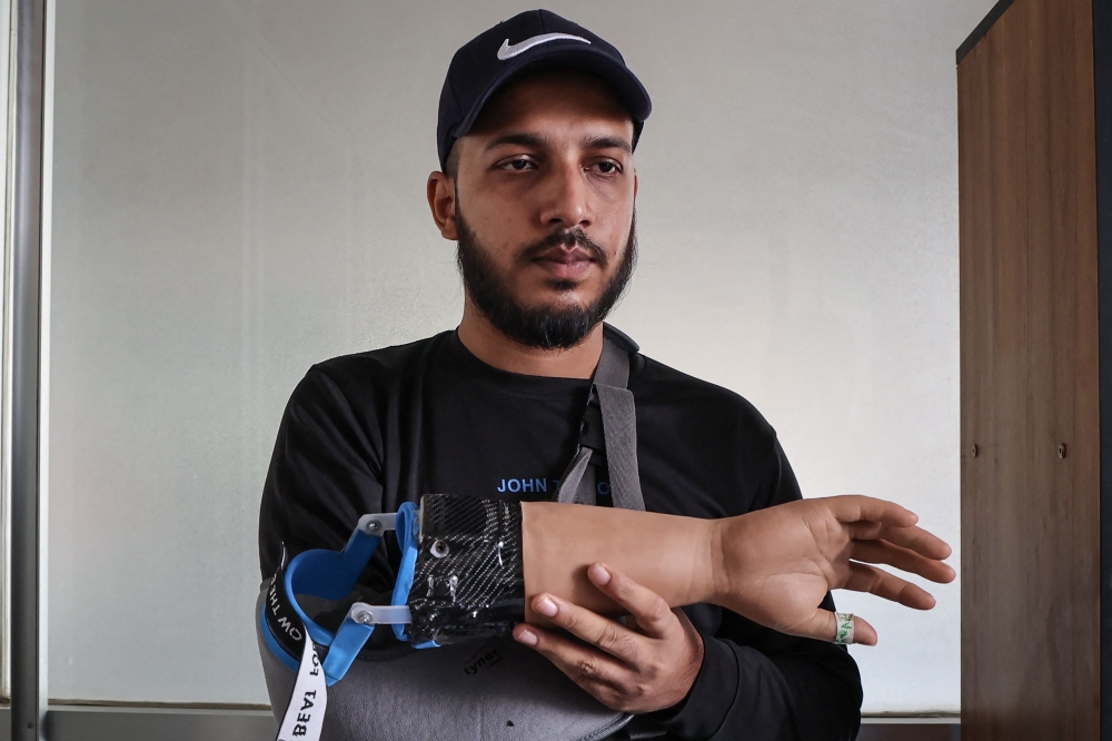 (Files) A protester who lost his arm in July's students' revolution holds a prosthetic arm manufactured by Robolife Technologies in Dhaka on November 21, 2024. (Photo by Abdul Goni / AFP)